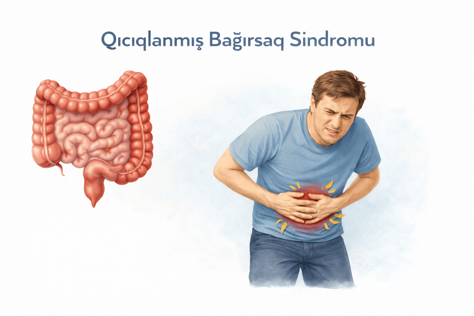 Qıcıqlanmış Bağırsaq Sindromu